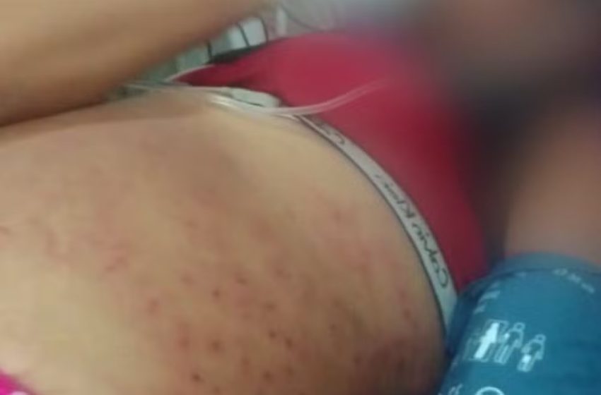 Mulher que levou 1,5 mil picadas de abelhas dentro de carro está internada em UTI: ‘Situação é grave’