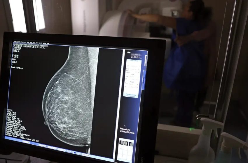 Falta de acesso a mamógrafos limita prevenção do câncer de mama