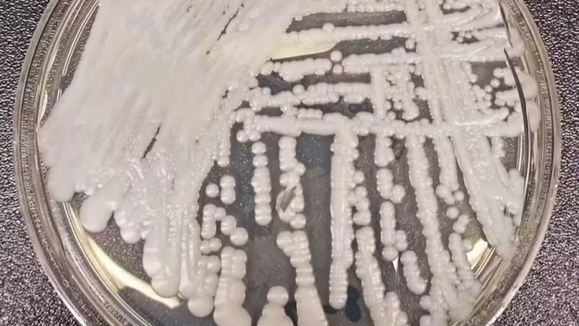  RN confirma caso de superfungo Candida auris em paciente internado em Natal