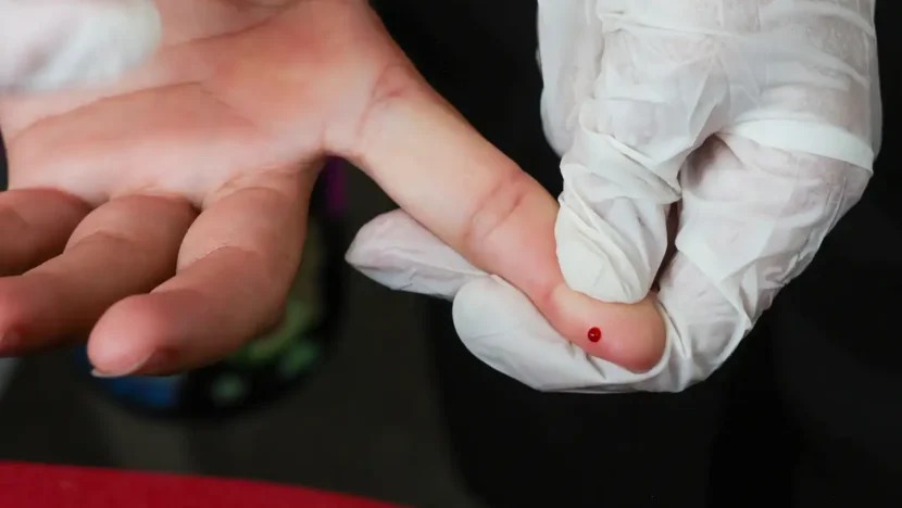  SUS passa a oferecer teste rápido de dengue